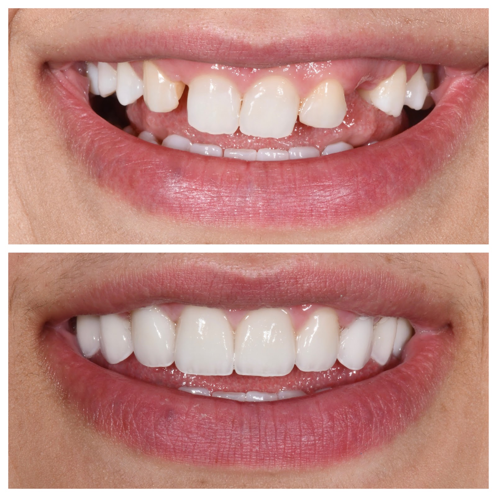 Birmingham Dental Care in Birmingham